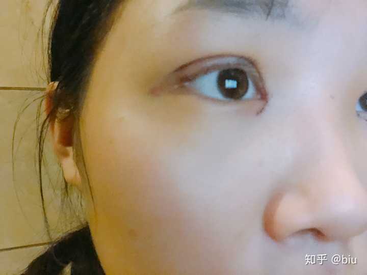 这个动作是眼睛使劲在往上翻 因为医生说多翻白眼双眼皮好形成