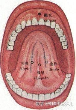 舌下" 金津玉液"二穴,取出淤积在大脑,脏腑,血液中的血毒,血垃圾和栓