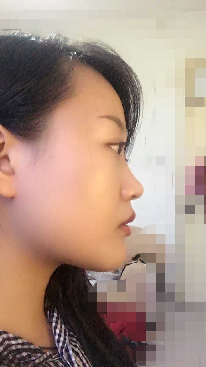 正脸好看,侧脸丑哭是种什么样的体验?