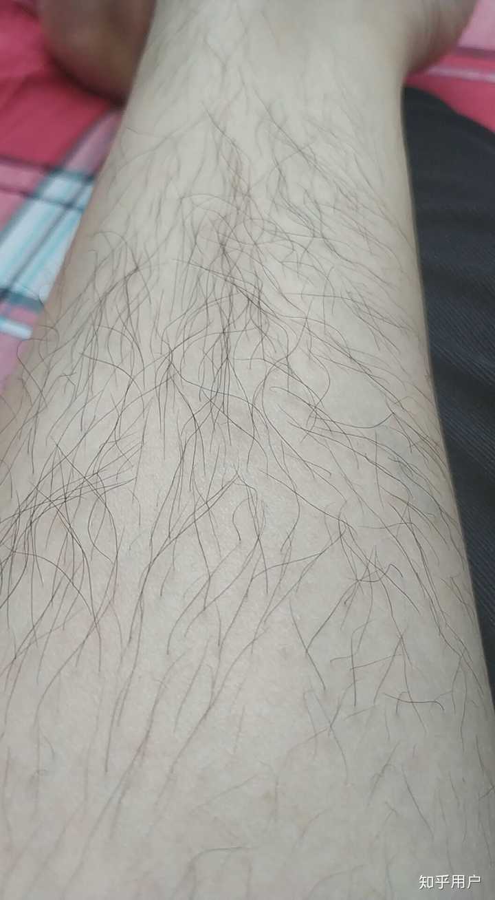 腿毛茂盛的男生夏天应该刮腿毛吗?
