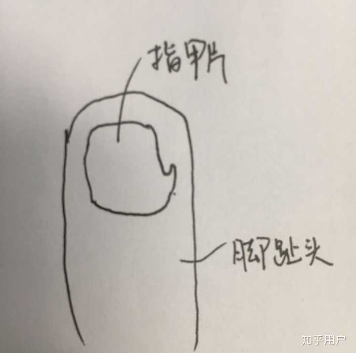 每天消毒后换棉花.