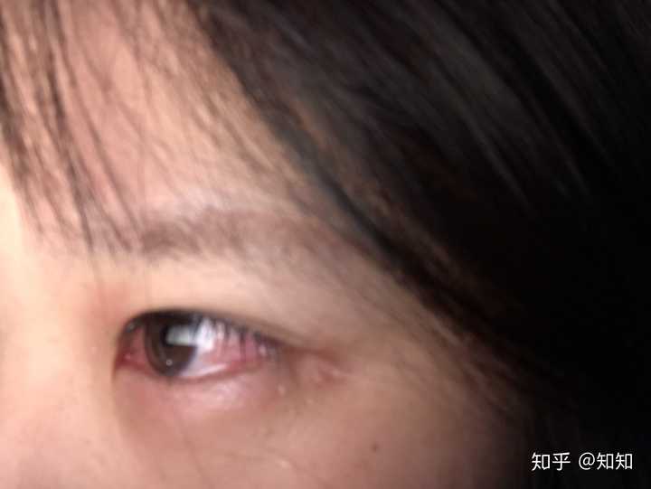 得了抑郁症的人眼神是不是都是一样的?