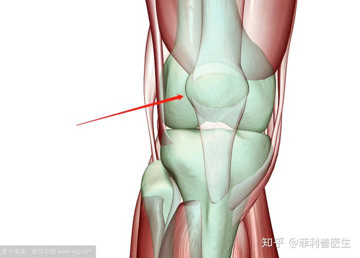 髌骨就像镶嵌在肌腱里面的一颗宝石,上面就连接着股四头肌(图片来源见