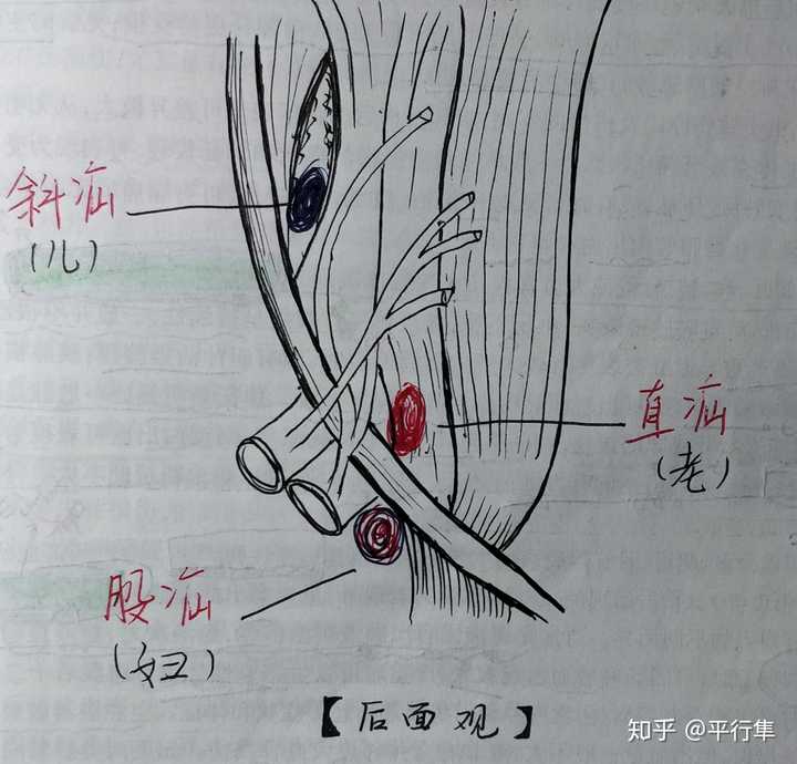 斜疝,直疝,股疝