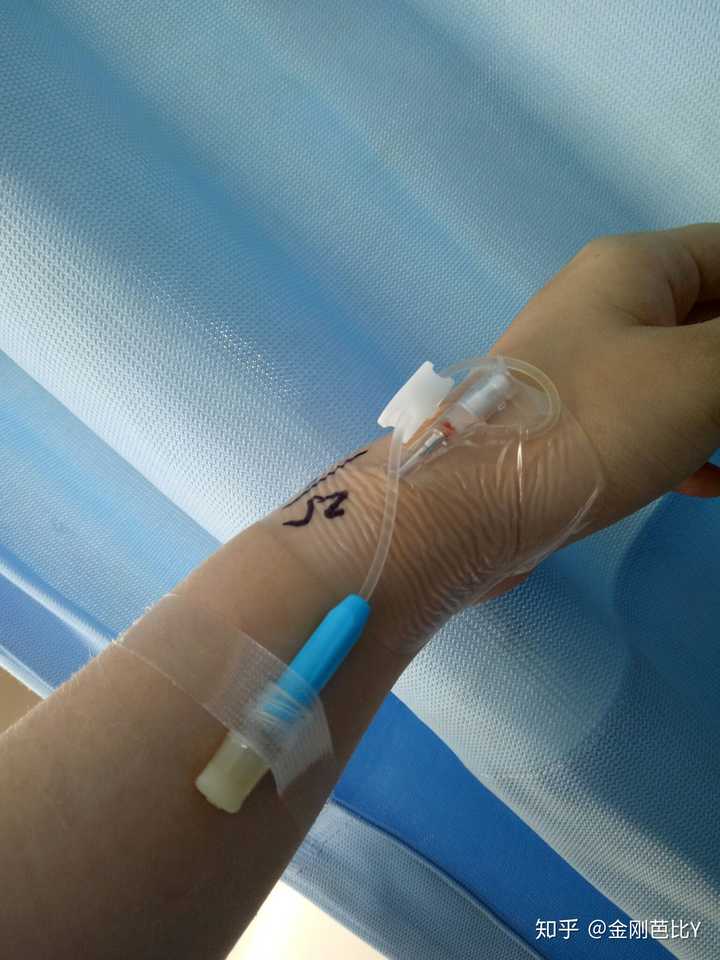 经历痔疮手术是怎样一种体验?