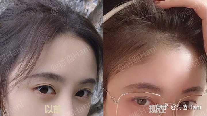 怎么弄出鞠婧祎这种的发际线的胎毛?