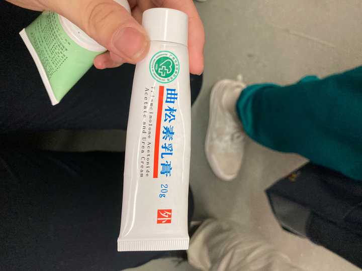 手部湿疹能根治吗?