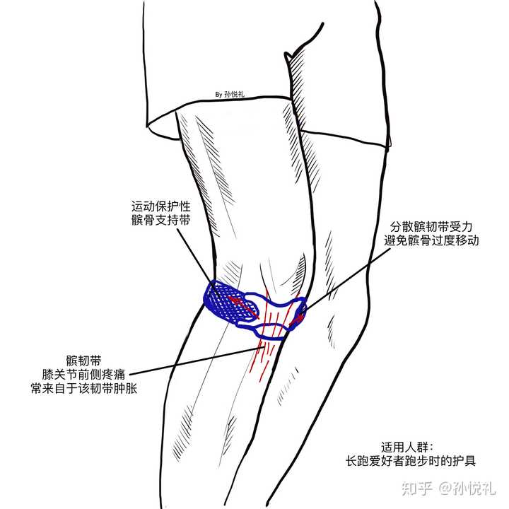 一般绑在膝关节髌骨下方的位置,这个部位在解剖上称为「膑韧带」,在这