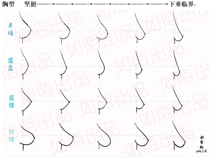 *其他胸型下垂的形态从视觉上确实和纺锤胸相近.