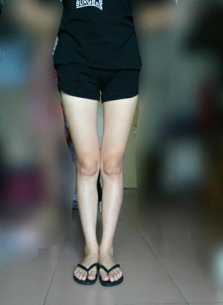 大家看看我的腿是不是x型腿,以前没怎么注意,室友说我的腿型不好看,有