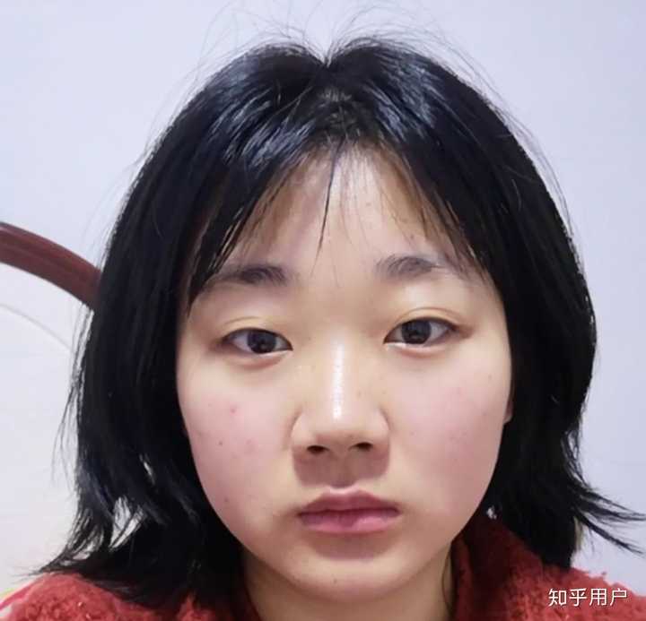 左右脸不对称怎么办(带图?