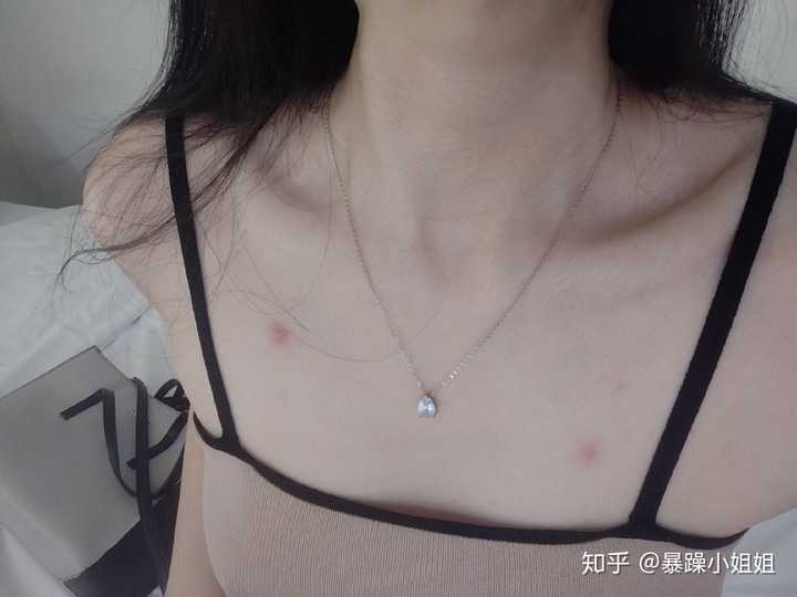 放一张锁骨照嘻嘻(来这里起了两个红疹子不知道是被咬了还是过敏)