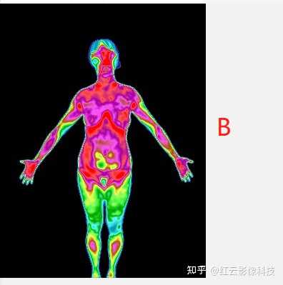 红外热成像健康检测在大健康行业应用及落地方案提供者