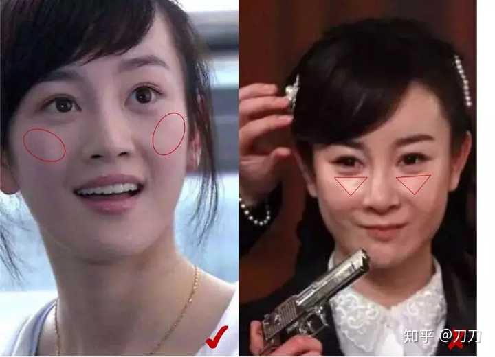 苹果肌和高颧骨有什么区别?