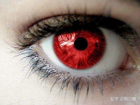 白化病人由于缺乏黑色素,因此眼睛呈现的其实是血管与血液的颜色