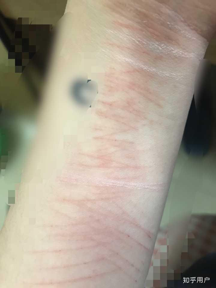 抑郁症的症状都有哪些?