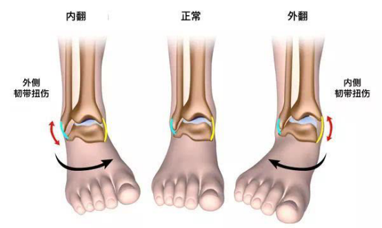 这两块骨头是由肌腱与韧带结合一起的 , 这个关节的底半部就是脚踝骨