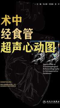 术中经食管超声心动图 马小静 何亚峰 吴洋 著 阅文出版知乎电子书
