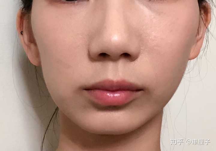 脸型极度不对称是什么体验?