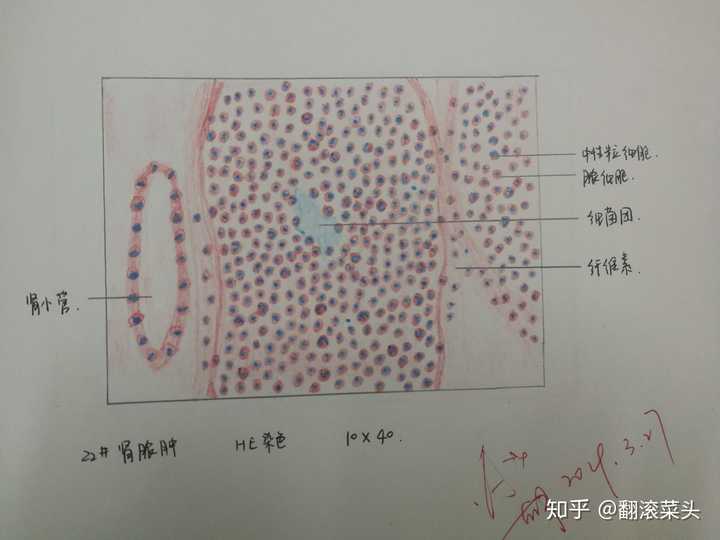 为什么咱们不弄个病理红蓝手绘图的问题呢?