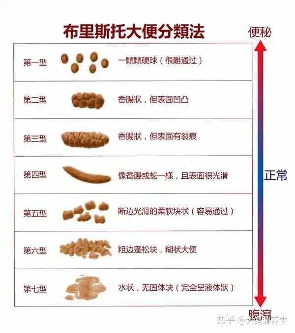 大便颜色:正常大便呈现黄色或黄褐色