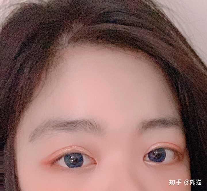 天生双眼皮太像割的是种怎样的体验?