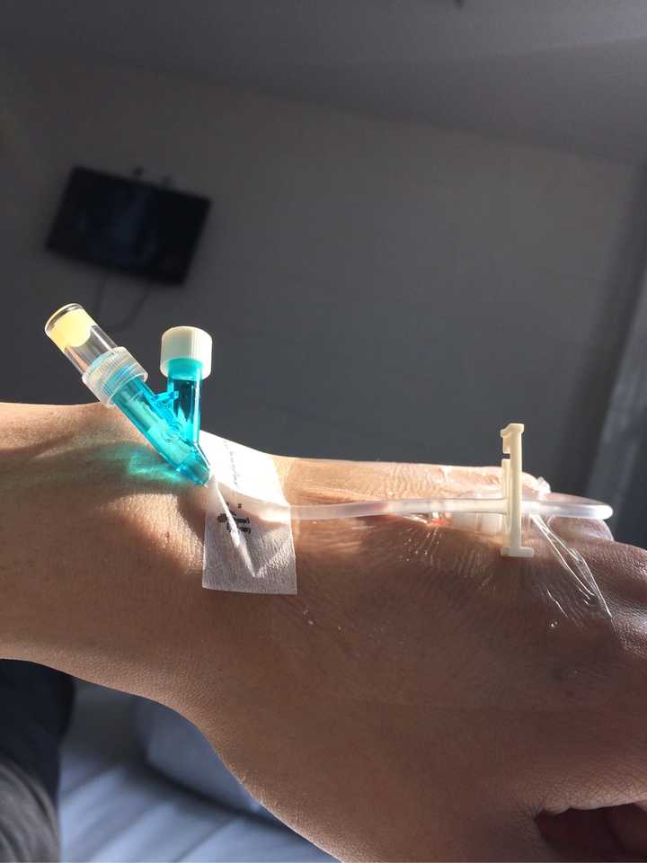 马上就要做肛瘘手术了,可以告诉我详情,让我不要害怕嘛?