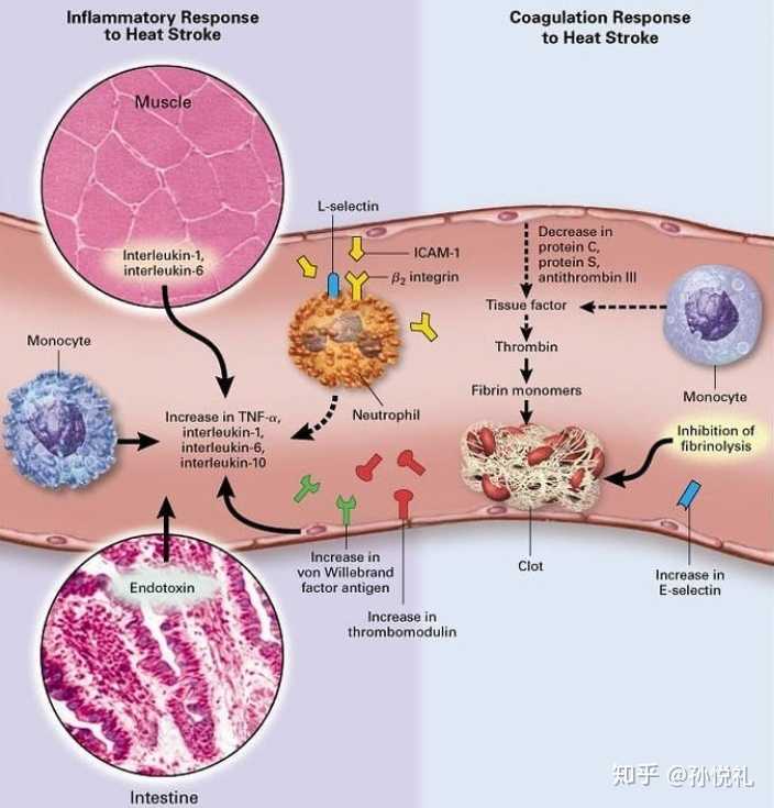 会使肌肉和肠道向全身血管释放白介素和内毒素,通过血管内部的炎症