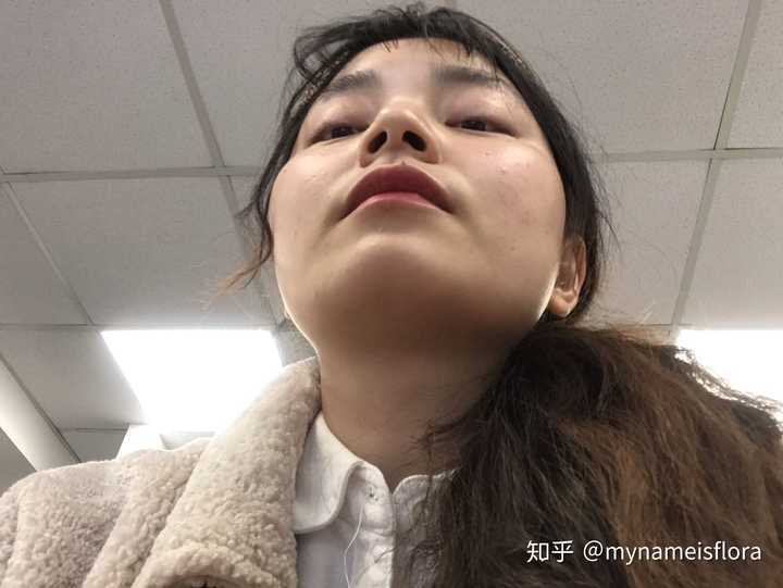 颧骨高很丑吗?
