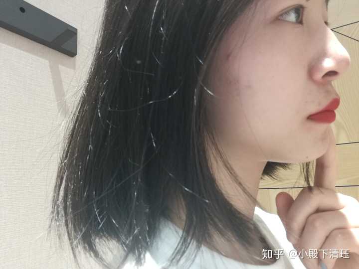 侧脸是这样,上嘴唇很凸,照出来不是很明显,大学毕业有同学照的我侧脸