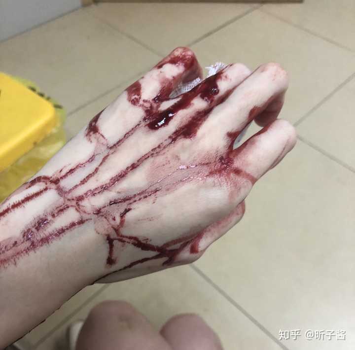 手指被割掉一块肉是什么体验?