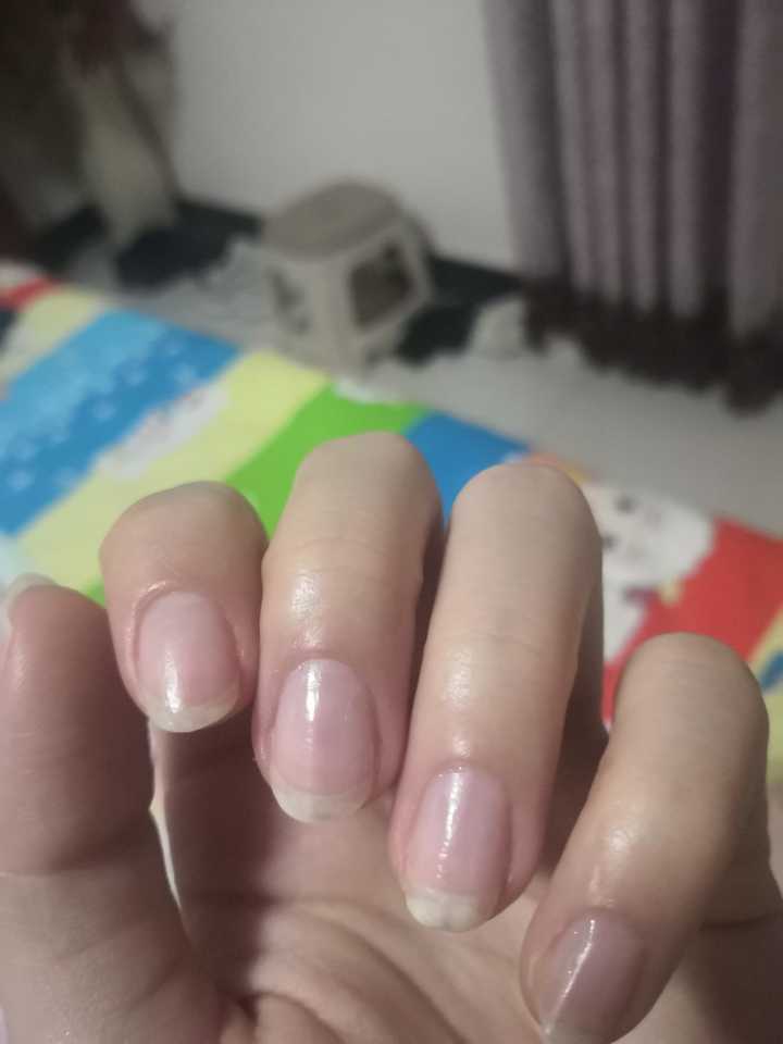 指甲很短而且很丑怎么办?