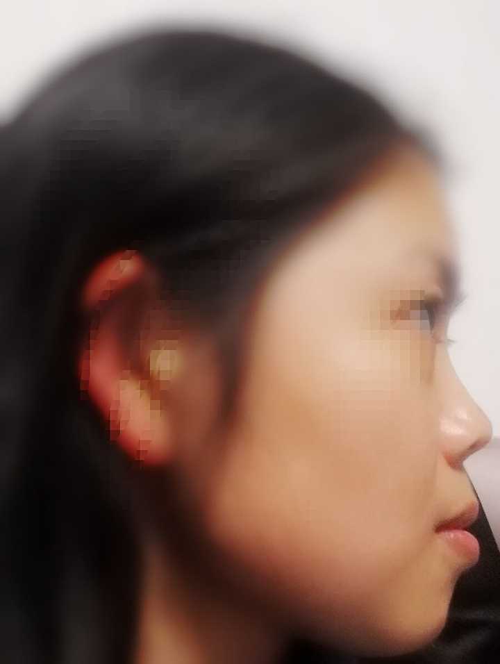 正脸好看,侧脸丑哭是种什么样的体验?