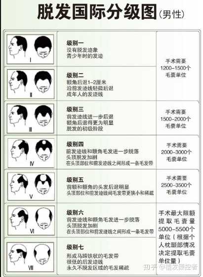 2,秃顶 3,斑秃 4,头皮有疤痕 5,脱发等级图,可以自己对照看看 无论是