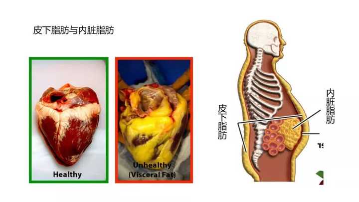 如何判断自己是否肥胖?