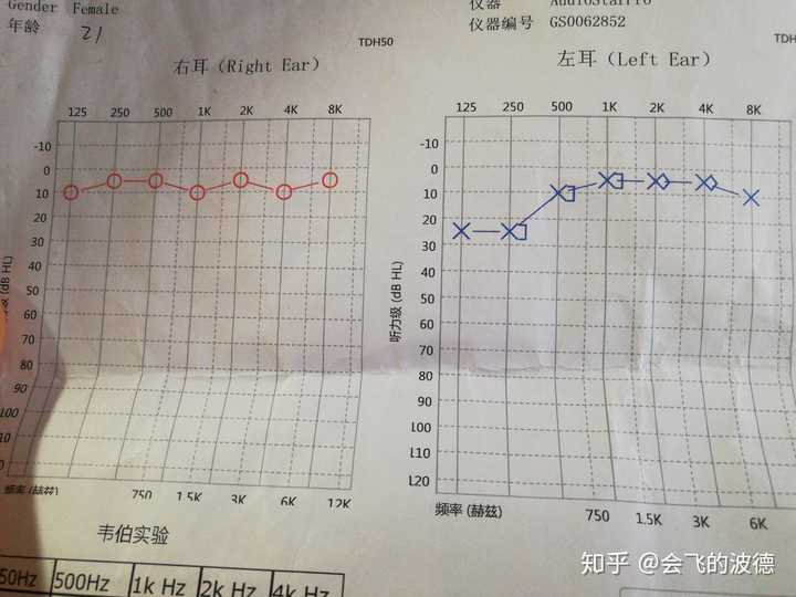 这是我差不多一周前后的听力测试图,图二左耳听力有些下降,但其他