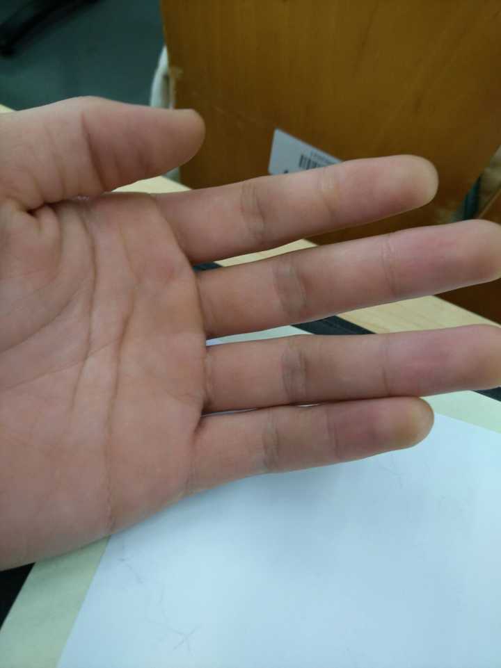 另外两根手指不要动,手腕带动这一点在平时弹琴也是如此