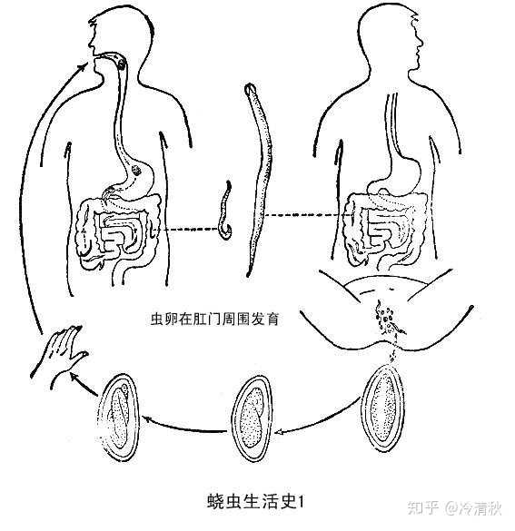 ② 说到蛔虫,必须要强调一下