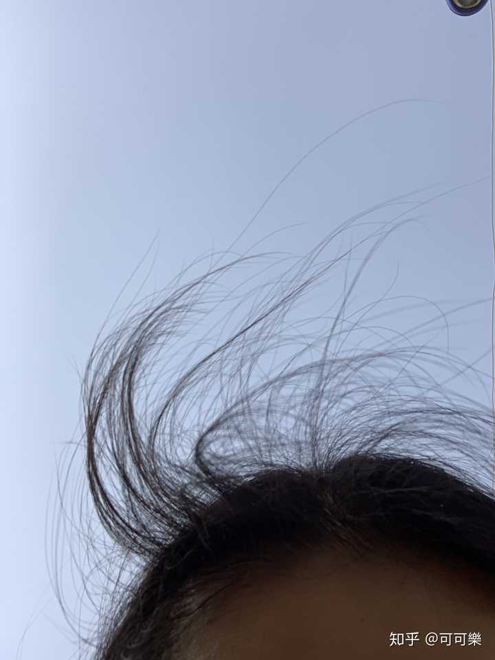 这是洗完头第二天,出门溜达了一圈,发现自己竟然长了这么多小碎发