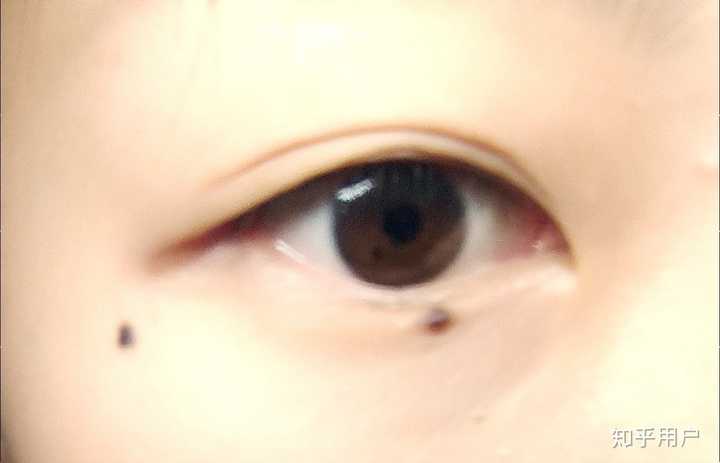 历史上的重瞳子是真实存在的吗?两个瞳仁在眼睛里是如何分布的?