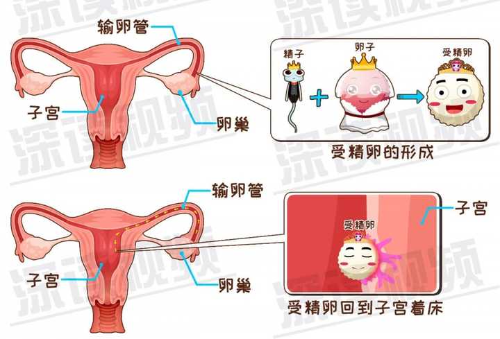 宫外孕是怎么回事儿?