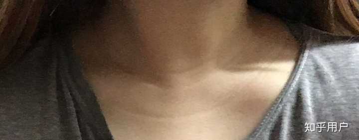 早上跟妈妈聊天妈妈说我脖子肩膀好像瘦点了 嘿嘿嘿好像是有一丢丢