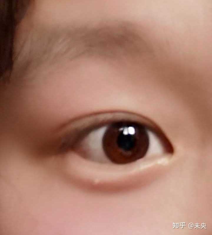 为什么有的中国人的眼珠是黄棕色的.