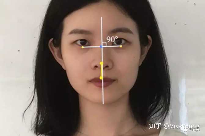 (羊要先强调一点,严重偏颌是必须通过手术来矫正)