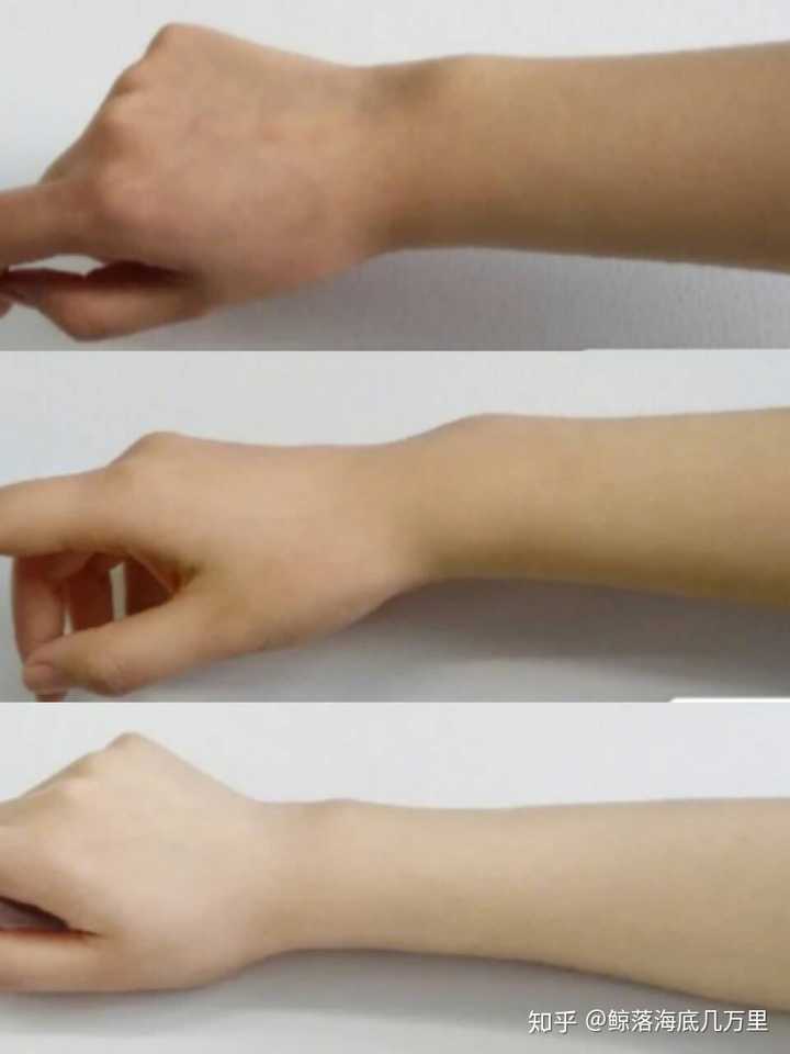 胳膊黑该怎么美白修复?