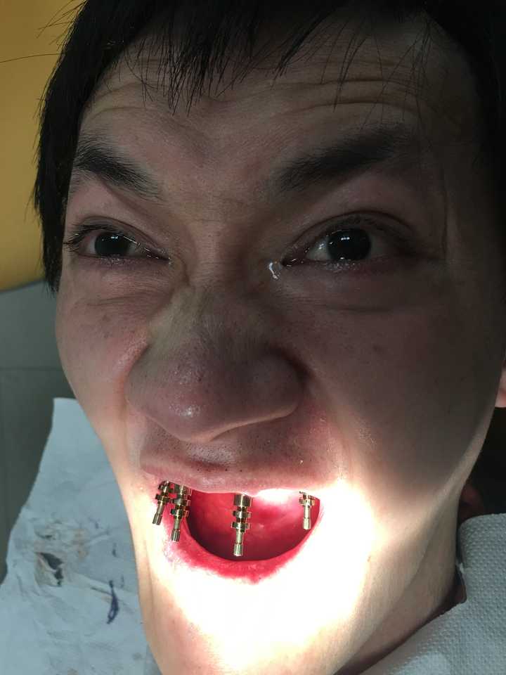 情侣之间会嘴对嘴喂食吗?