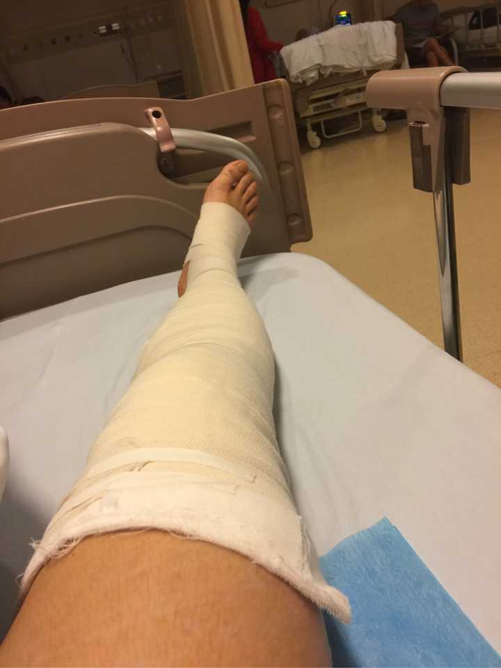 手术-腿是这样的