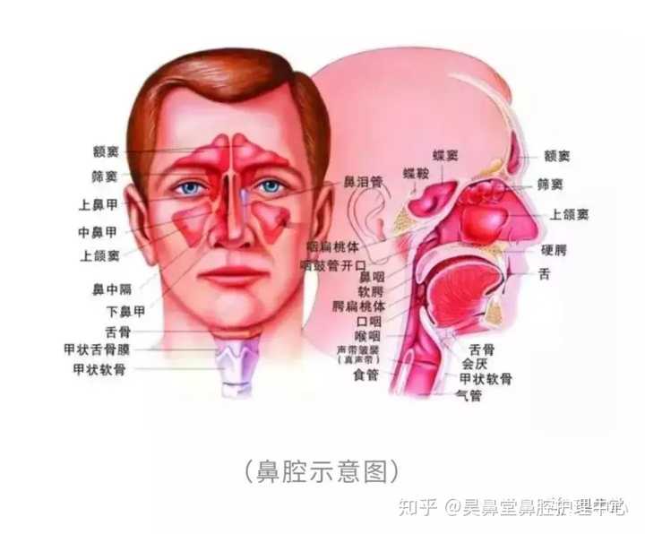 通常讲的鼻腔癌症或者鼻窦癌,是指鼻部或者鼻窦的恶性肿瘤,最