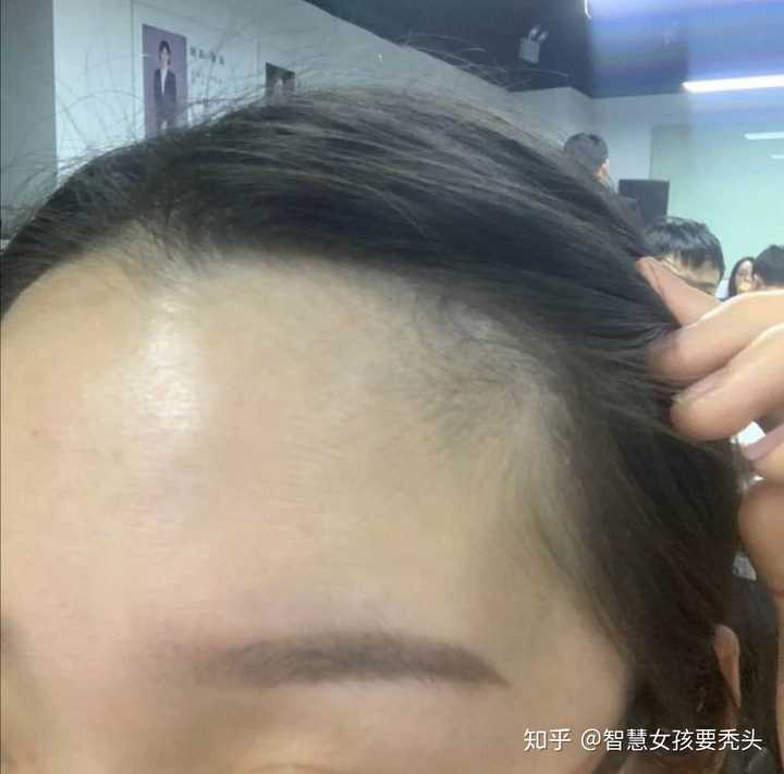 哎,放个黑照让你看我当时的发际线你就知道了