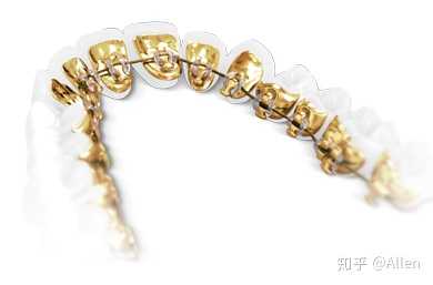 incognito舌侧矫正器(16k黄金打造)
